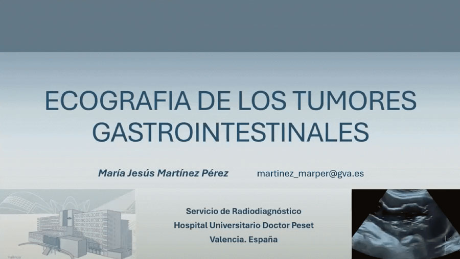 ecografia de tumores