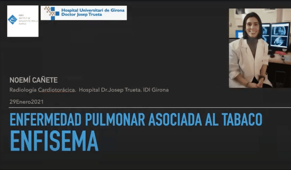 Noemí Cañete. Radiología Cardiotorácica. Hospital Dr. Josep Trueta. IDI Giriona