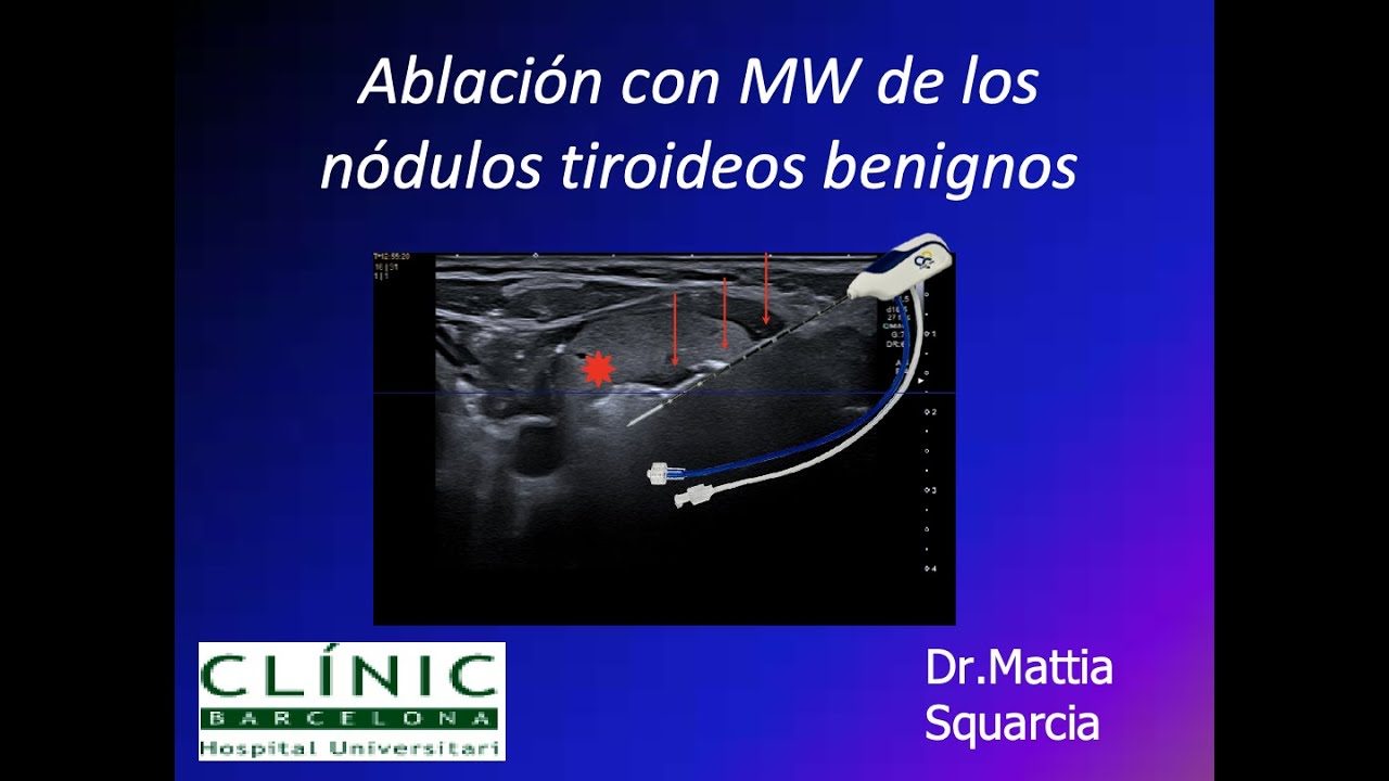 miniatura del curso