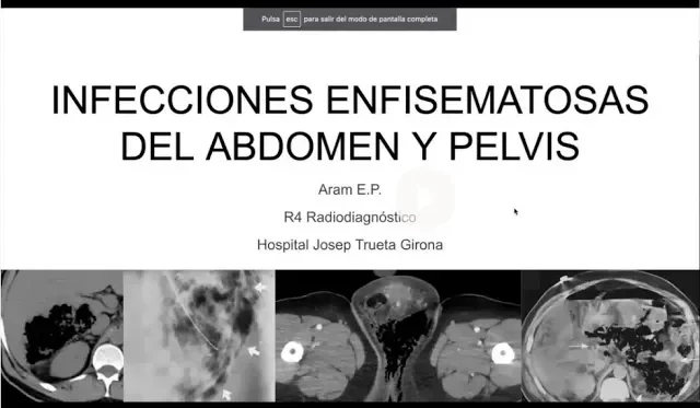 miniatura del curso