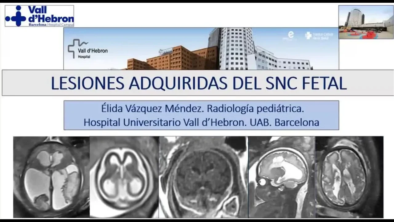 miniatura del curso