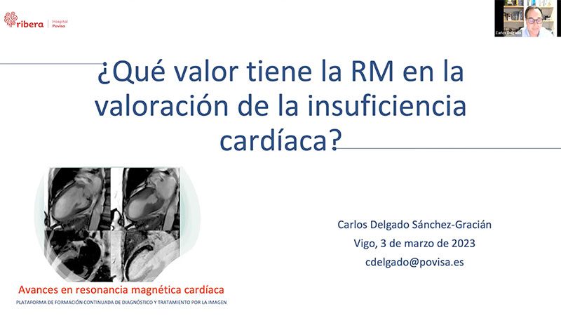 miniatura del curso