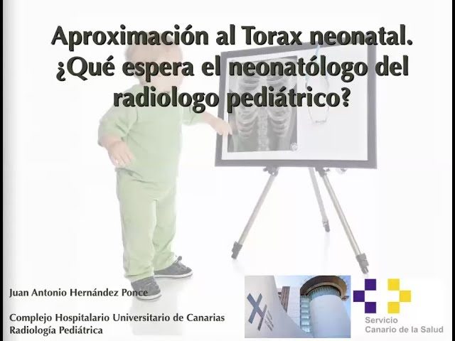 miniatura del curso