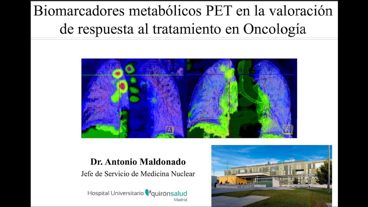 miniatura del curso