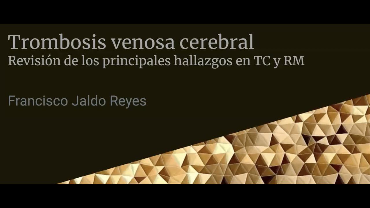 miniatura del curso