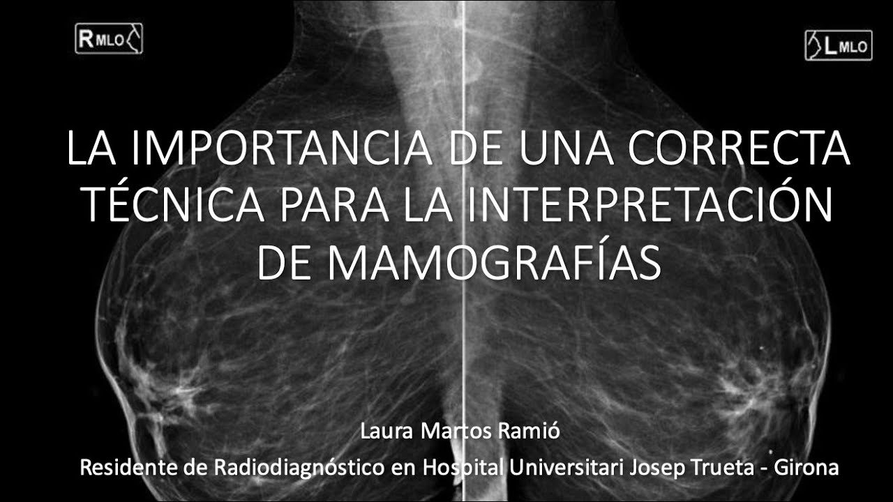 miniatura del curso