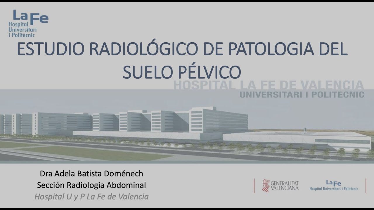 miniatura del curso
