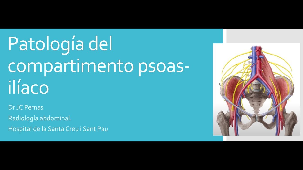 miniatura del curso