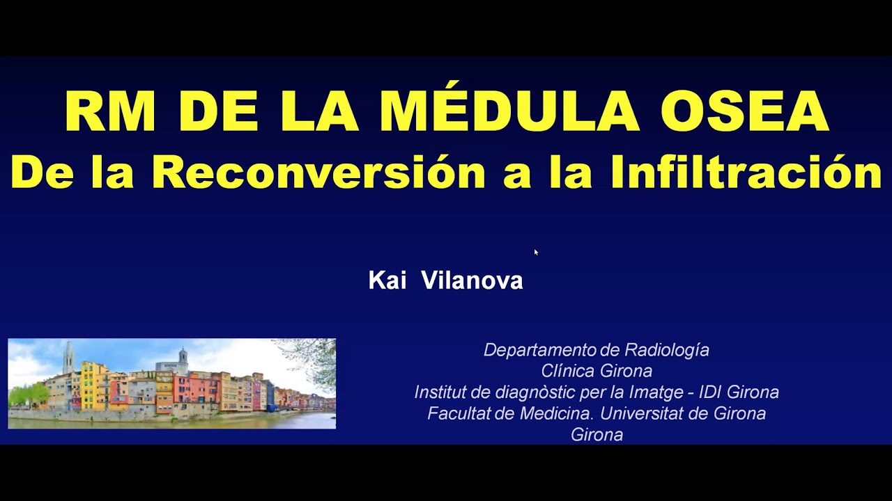 miniatura del curso