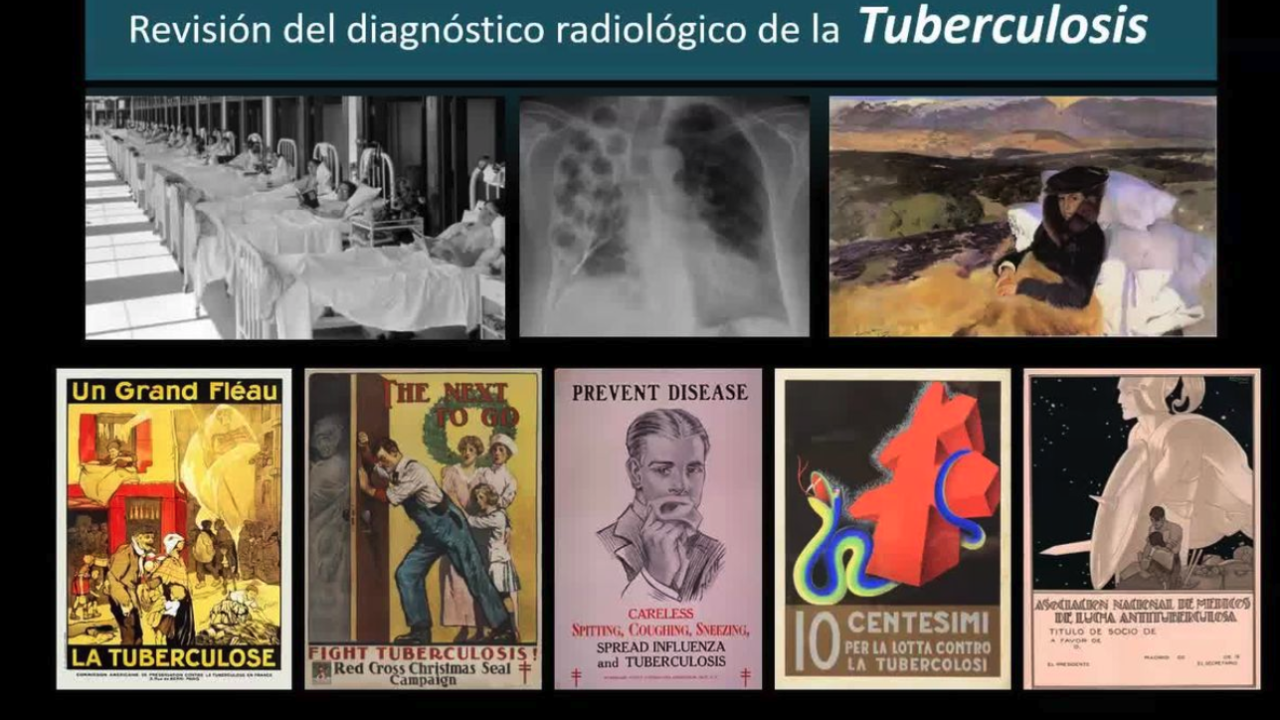 miniatura del curso