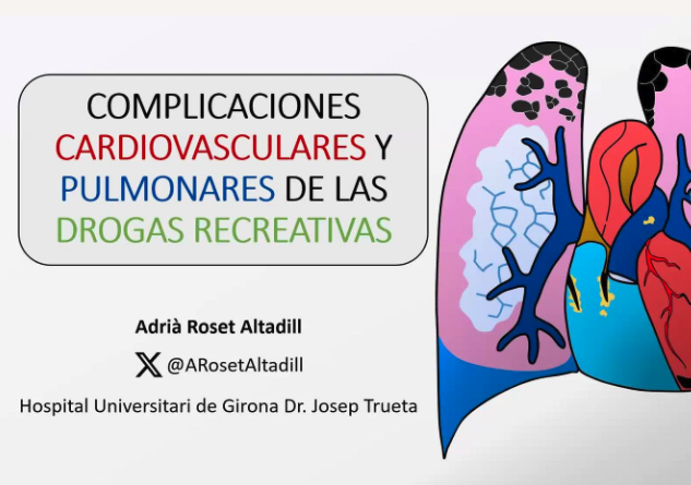 miniatura del curso