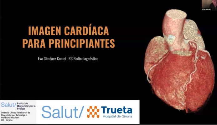 795- Imagen cardíaca para principiantes